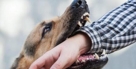 Dog Biting Person's Hand