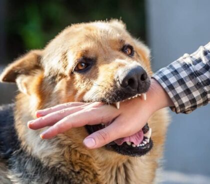 Dog Biting Person's Hand