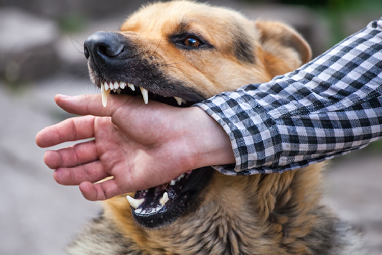 Dog Biting Person's Hand